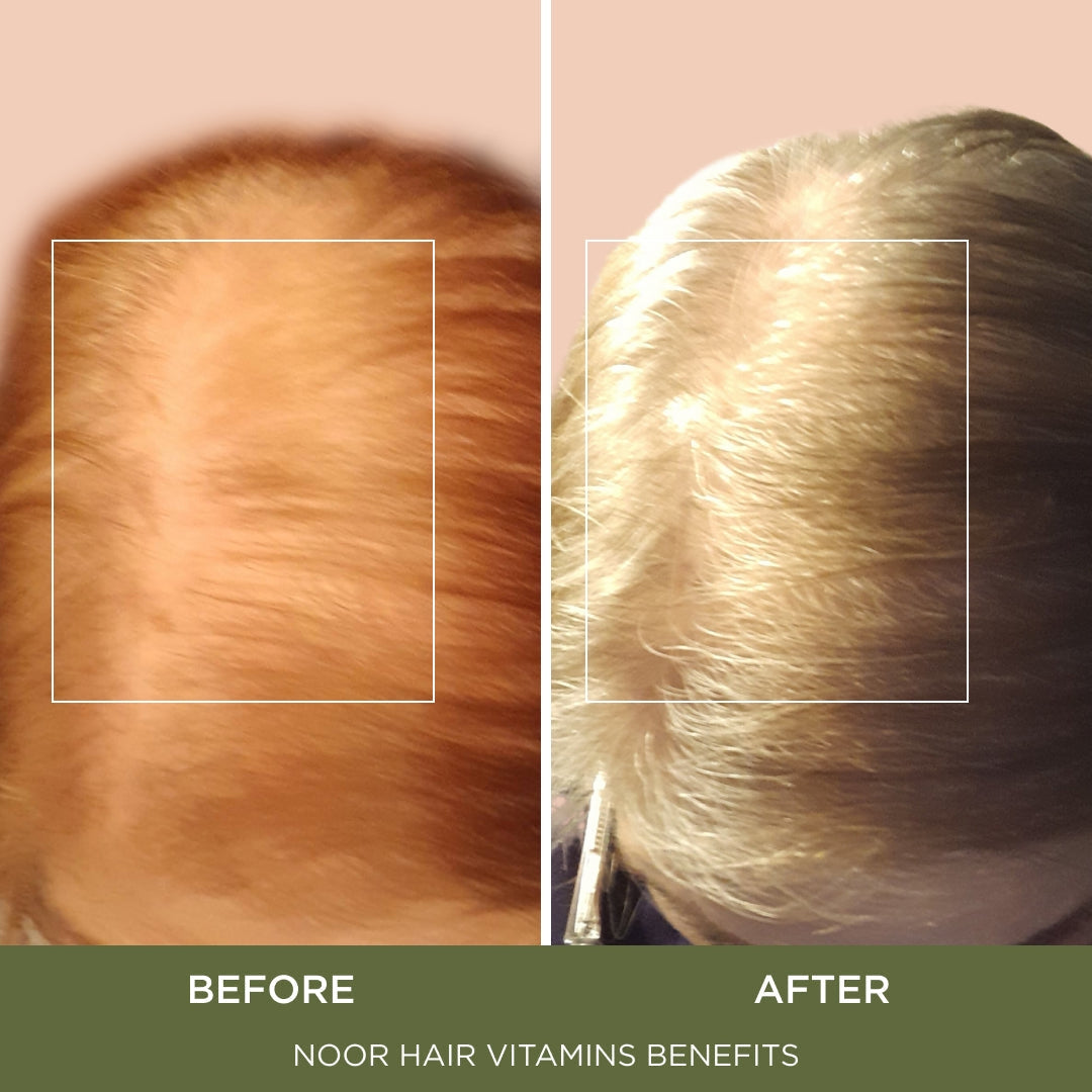 Healthy Hair Formula, Hair Growth Supplement Supporting Thick Hair and Fast Hair Regrowth. Vitamin C, B6, Zinc, Propietary Non-GMO & Gluten Free Womens Hair Loss Vitamins - 30 Day Supply