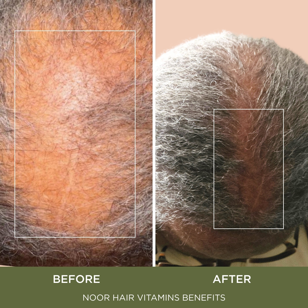 Healthy Hair Formula, Hair Growth Supplement Supporting Thick Hair and Fast Hair Regrowth. Vitamin C, B6, Zinc, Propietary Non-GMO & Gluten Free Womens Hair Loss Vitamins - 30 Day Supply