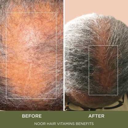 Healthy Hair Formula, Hair Growth Supplement Supporting Thick Hair and Fast Hair Regrowth. Vitamin C, B6, Zinc, Propietary Non-GMO & Gluten Free Womens Hair Loss Vitamins - 30 Day Supply