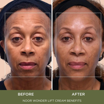 Wonder Lift Cream for Women, Natural Anti-Aging Wrinkle teatment with Syn-Ake natural blend Promotes Anti Aging and Significantly Less Wrinkles In As Little As A Few Days
