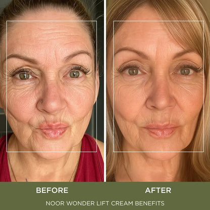 Wonder Lift Cream for Women, Natural Anti-Aging Wrinkle teatment with Syn-Ake natural blend Promotes Anti Aging and Significantly Less Wrinkles In As Little As A Few Days